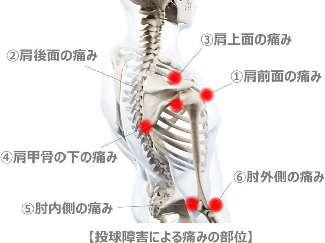 投球障害 Aks療法 Aka進化系 脊柱管狭窄症 椎間板ヘルニア改善専門